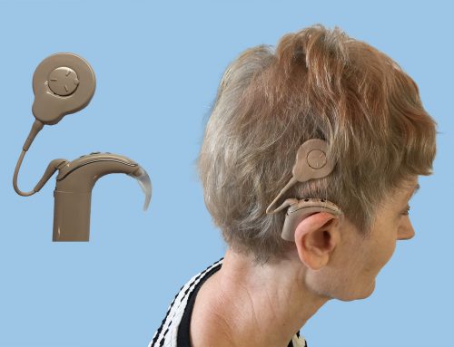 Cathy’s Bilateral Cochlear Implant Journey